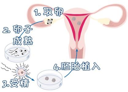 李雪梅